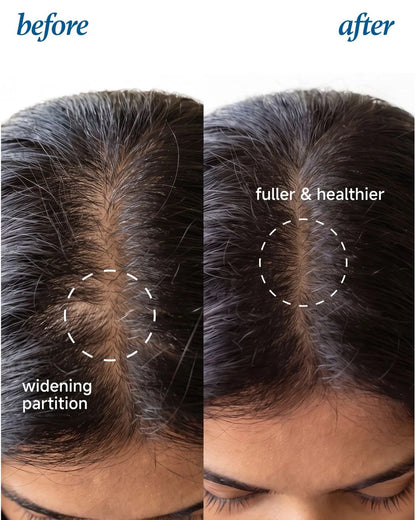 Advanced Hair Growth Serum Roll On (25ml)