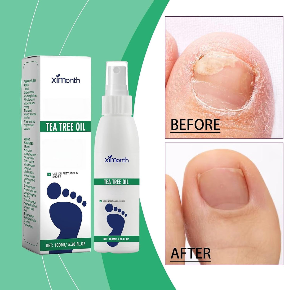 Ximonth Tea Tree Oil Foot Sanitizer Spray, 100 ml
